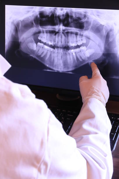 Best Emergency Dental Care for Broken or Chipped Teeth in Mobridge, SD