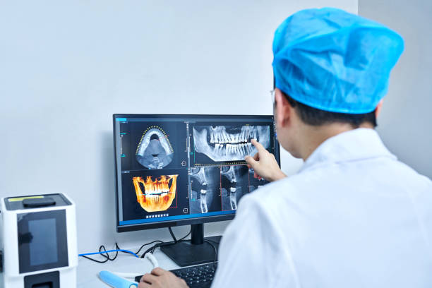 Best Emergency Dental Care for Broken or Chipped Teeth in Mobridge, SD